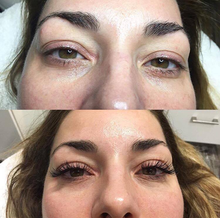 Eyelash Extensions & Tinting Before and After Pictures Boston, MA