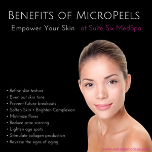 Microdermabrasion in Newburyport, MA